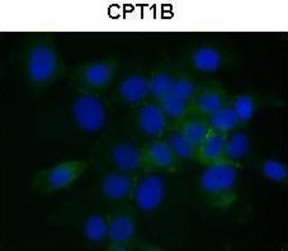 Anti-CPT1B antibody produced in rabbit affinity isolated antibody