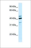 Anti-HYAL1 (ab1) antibody produced in rabbit affinity isolated antibody