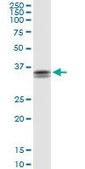 Anti-STX11 antibody produced in rabbit purified immunoglobulin, buffered aqueous solution