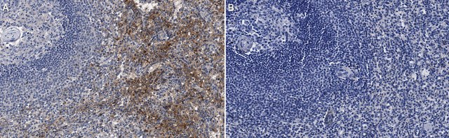 Anti-RANTES/CCL5 Antibody, clone 15B5.6