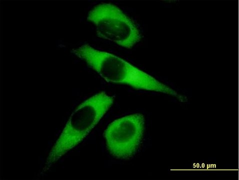 Anti-MARS antibody produced in mouse purified immunoglobulin, buffered aqueous solution