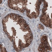 Monoclonal Anti-GORASP2 antibody produced in mouse Prestige Antibodies® Powered by Atlas Antibodies, clone CL2522, purified immunoglobulin, buffered aqueous glycerol solution