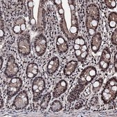Anti-CHMP7 antibody produced in rabbit Prestige Antibodies® Powered by Atlas Antibodies, affinity isolated antibody, buffered aqueous glycerol solution