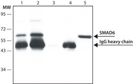 Anti-SMAD6 (N-terminal) antibody produced in rabbit ~1.0 mg/mL, affinity isolated antibody