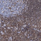 Anti-CELF2 antibody produced in rabbit Prestige Antibodies® Powered by Atlas Antibodies, affinity isolated antibody, buffered aqueous glycerol solution