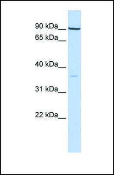 Anti-NKX2-5, (N-terminal) antibody produced in rabbit affinity isolated antibody