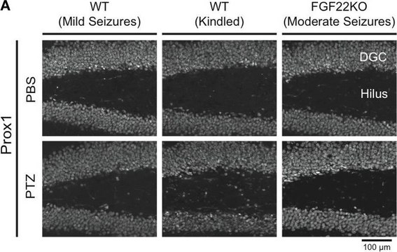 Anti-Neurofilament 200 kDa Antibody, clone NE14 clone NE14, Chemicon&#174;, from mouse