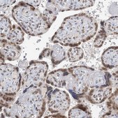 Anti-TREX1 antibody produced in rabbit Prestige Antibodies® Powered by Atlas Antibodies, affinity isolated antibody, buffered aqueous glycerol solution