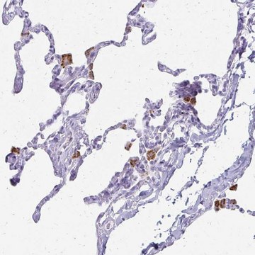 Anti-ACP5 antibody produced in rabbit Prestige Antibodies&#174; Powered by Atlas Antibodies, affinity isolated antibody, buffered aqueous glycerol solution