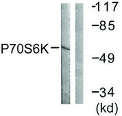 Anti-p70 S6 Kinase antibody produced in rabbit affinity isolated antibody