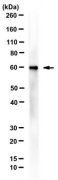 Anti-EBNA-1 Antibody, clone 1EB14