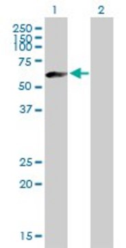 Anti-IGHM antibody produced in mouse purified immunoglobulin, buffered aqueous solution