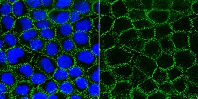 Anti-Desmoglein 2 Antibody, clone 6D8 clone 6D8, from mouse