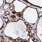 Anti-OSBPL5 antibody produced in rabbit Prestige Antibodies® Powered by Atlas Antibodies, affinity isolated antibody, buffered aqueous glycerol solution