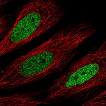 Anti-CEBPD antibody produced in rabbit Prestige Antibodies&#174; Powered by Atlas Antibodies, affinity isolated antibody