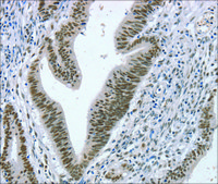 Anti-RNF20 affinity isolated antibody