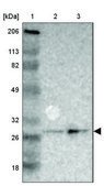 Anti-SDHB antibody produced in rabbit Ab1, Prestige Antibodies® Powered by Atlas Antibodies, affinity isolated antibody, buffered aqueous glycerol solution