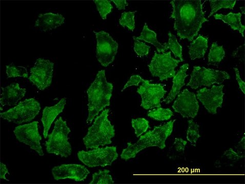 Monoclonal Anti-ROCK1 antibody produced in mouse clone 2E2, purified immunoglobulin, buffered aqueous solution