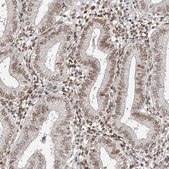 抗-ZNF503 兔抗 Prestige Antibodies® Powered by Atlas Antibodies, affinity isolated antibody, buffered aqueous glycerol solution