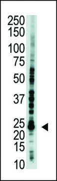 ANTI-E2EPF(C-TERMINAL) antibody produced in rabbit IgG fraction of antiserum, buffered aqueous solution