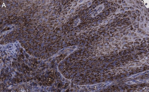 Anti-FAM49A Antibody, clone 2D6 ZooMAb&#174; Rabbit Monoclonal recombinant, expressed in HEK 293 cells