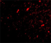 Anti-SCRAPPER (ab2) antibody produced in rabbit affinity isolated antibody, buffered aqueous solution