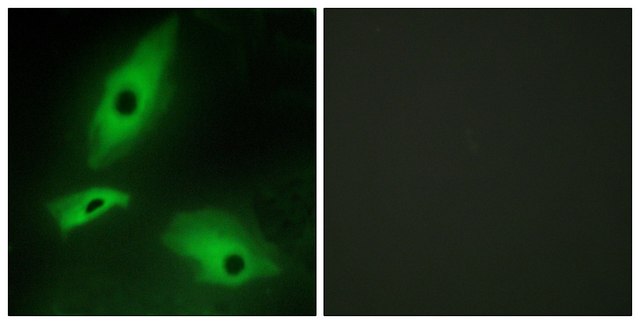 Anti-LTBR antibody produced in rabbit affinity isolated antibody