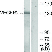 Anti-VEGFR2 antibody produced in rabbit affinity isolated antibody