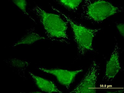 Monoclonal Anti-DECR2 antibody produced in mouse clone 4A7, purified immunoglobulin, buffered aqueous solution