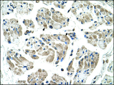 Anti-CHST1 antibody produced in rabbit IgG fraction of antiserum