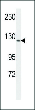 ANTI-VGFR1 antibody produced in rabbit purified immunoglobulin, buffered aqueous solution