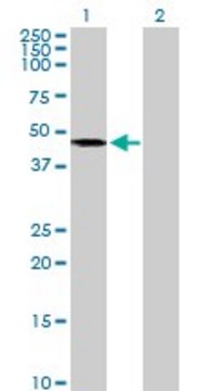 Anti-AGK antibody produced in mouse purified immunoglobulin, buffered aqueous solution