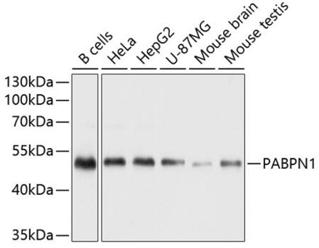 Anti-PABPN1 antibody produced in rabbit