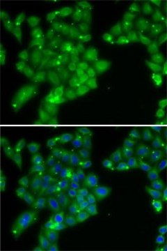 Anti-GCK antibody produced in rabbit