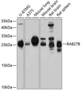 Anti-RAB27B antibody produced in rabbit