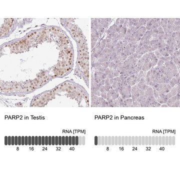 Anti-PARP2 antibody produced in rabbit Prestige Antibodies&#174; Powered by Atlas Antibodies, affinity isolated antibody, buffered aqueous glycerol solution