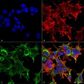 Monoclonal Anti-Lrrk2/Dardarin - Apc antibody produced in mouse clone S231B-34, purified immunoglobulin