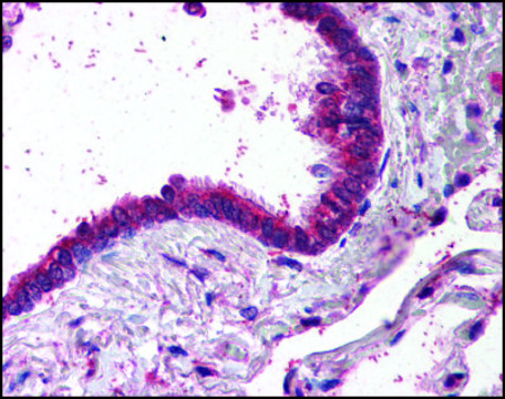 Anti-AP1G1 antibody produced in goat affinity isolated antibody, buffered aqueous solution