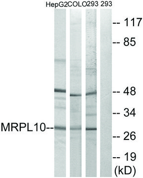 Anti-MRPL10 antibody produced in rabbit affinity isolated antibody