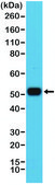 Anti-MUM1/IRF4 antibody, Rabbit monoclonal recombinant, expressed in HEK 293 cells, clone RM352, purified immunoglobulin