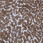 Anti-SLC25A13 antibody produced in rabbit Prestige Antibodies® Powered by Atlas Antibodies, affinity isolated antibody, buffered aqueous glycerol solution