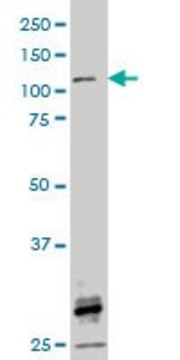 ANTI-FGFR1 antibody produced in mouse clone 3C9, purified immunoglobulin, buffered aqueous solution