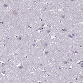 Anti-CRB2 antibody produced in rabbit Prestige Antibodies® Powered by Atlas Antibodies, affinity isolated antibody, buffered aqueous glycerol solution