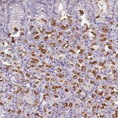 Anti-SLC26A9 antibody produced in rabbit Prestige Antibodies® Powered by Atlas Antibodies, affinity isolated antibody, buffered aqueous glycerol solution