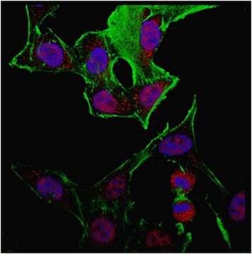 Anti-TLE1 Antibody from rabbit, purified by affinity chromatography