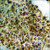 Anti-phospho-Smad3 (pSer213) antibody produced in rabbit affinity isolated antibody