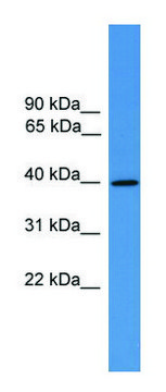 Anti-AVPR2 (C-terminal) antibody produced in rabbit affinity isolated antibody