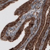 Monoclonal Anti-CARS antibody produced in mouse Prestige Antibodies® Powered by Atlas Antibodies, clone CL2302, purified immunoglobulin, buffered aqueous glycerol solution