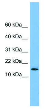 Anti-SPA17 (N-terminal) antibody produced in rabbit affinity isolated antibody