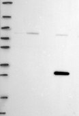 Anti-Stk3 Antibody Produced In Rabbit Prestige Antibodies® Powered by Atlas Antibodies, affinity isolated antibody, buffered aqueous glycerol solution